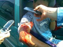 sidor_worker_wounded1